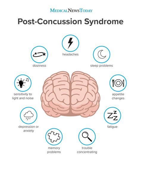 The post-concussion syndrome may develop after a concussive event (a fall, a motor vehicle accident, a contact sport injury, and so forth). . What can a neurologist do for post concussion syndrome